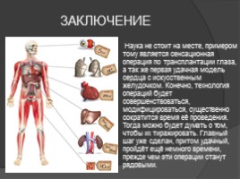 Трансплантация органов и тканей, слайд 14