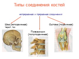 Урок по биологии 8 класс «Типы соединения костей», слайд 11