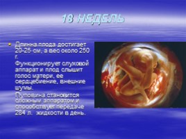 Рождение человека, слайд 31