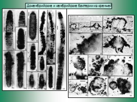 Бактериальная палеонтология, слайд 10