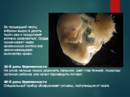 Внутриутробное развитие плода, слайд 5
