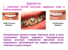 Строение и функции зубов, слайд 15