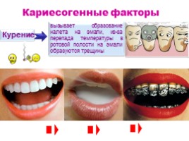Строение и функции зубов, слайд 19