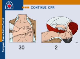 Basic Life Support & Automated External Defibrillation Course (на английском языке), слайд 19