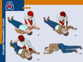 Basic Life Support & Automated External Defibrillation Course (на английском языке), слайд 30