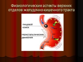 Заболевания верхних отделов желудочно-кишечного тракта, язва, слайд 5
