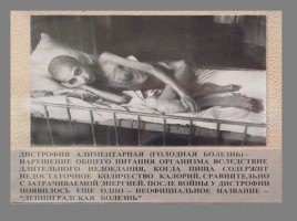 Фотографии-свидетели истории блокадного Ленинграда, слайд 14
