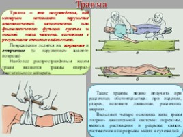 Первая медицинская помощь при травмах (8 класс), слайд 3