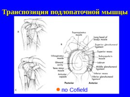Травматология и ортопедия повреждений и заболеваний плечевого сустава-1, слайд 27