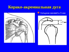 Травматология и ортопедия повреждений и заболеваний плечевого сустава-1, слайд 7
