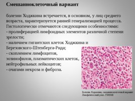 Опухоли кроветворной и лимфоидной тканей Часть II, слайд 52