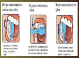 Как и чем чистить зубы. Предметы и средства гигиены полости рта. Методы чистки зубов., слайд 20