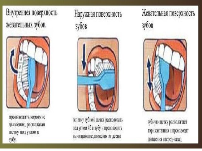 Презентация почему нужно чистить зубы