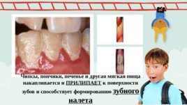 Роль питания в профилактике стоматологических заболеваний, слайд 7