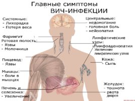 Подросток и ВИЧ – проблема и решение, слайд 20