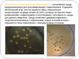 Общая Микробиология, слайд 15