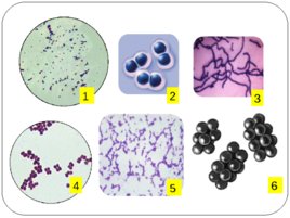 Общая Микробиология, слайд 6
