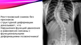 Помогите позвоночнику, и он поможет вам обрести молодость, слайд 26