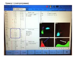 Основные лабораторные показатели оценки эритропоэза, получаемые на гематологических анализаторах, слайд 22