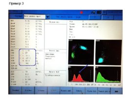 Основные лабораторные показатели оценки эритропоэза, получаемые на гематологических анализаторах, слайд 24