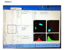 Основные лабораторные показатели оценки эритропоэза, получаемые на гематологических анализаторах, слайд 25