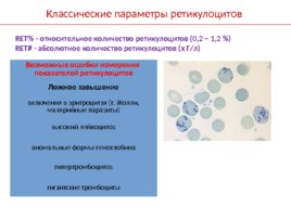 Основные лабораторные показатели оценки эритропоэза, получаемые на гематологических анализаторах, слайд 35