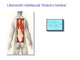 Taller de tratamiento de tejidos blandos aplicado en la Halterofilia, слайд 176