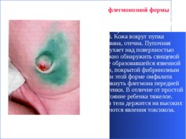 Гнойно-восполительные заболевания кожи и подкожной клетчатки у детей, слайд 45