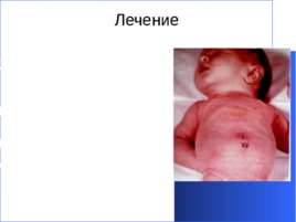 Гнойно-восполительные заболевания кожи и подкожной клетчатки у детей, слайд 47