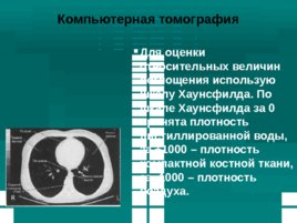 Методы рентгенодиагностики, слайд 52