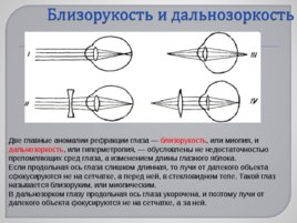 Сенсорные системы, слайд 31