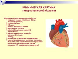 Заболевания сердца и беременность, слайд 44