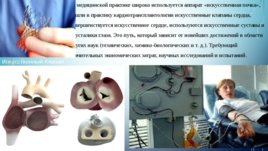 Проблемы создания искусственных органов для трансплантологии, слайд 3