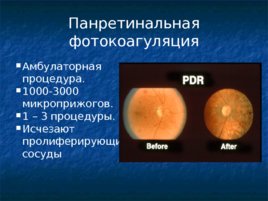 Глазные проявления общих заболеваний, слайд 50