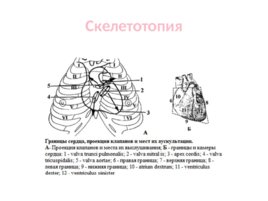 Топографическая анатомия и оперативная хирургия сердца, слайд 11