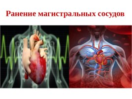 Топографическая анатомия и оперативная хирургия сердца, слайд 15