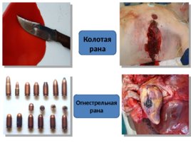 Топографическая анатомия и оперативная хирургия сердца, слайд 16