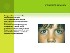 Нарушения зрения у детей дошкольного возраста, слайд 21