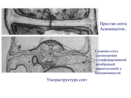 Грибы и грибоподобные организмы (mycota, или fungi), слайд 33