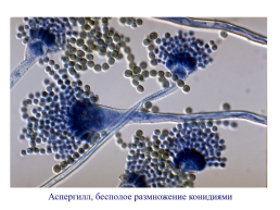 Грибы и грибоподобные организмы (mycota, или fungi), слайд 68