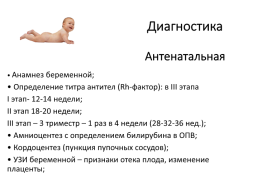 Гемолитическая болезнь новорожденных, слайд 17