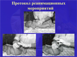 Асфиксия новорожденного. Родовая травма., слайд 24