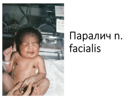 Асфиксия новорожденного. Родовая травма., слайд 34