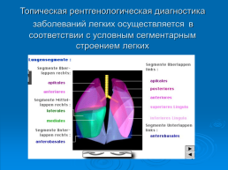 Дополнительные методы исследования в пульмонологии, слайд 26