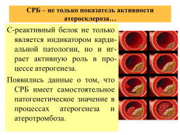 Лабораторные методы диагностики атеросклероза, слайд 35