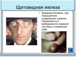Тренажер "железы организма человека", слайд 18