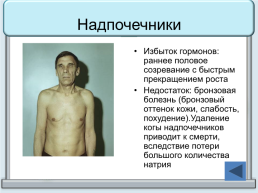 Тренажер "железы организма человека", слайд 19