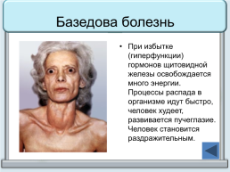 Тренажер "железы организма человека", слайд 29