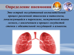 Проведение сестринского процесса при пневмонии, слайд 16