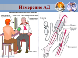 Проведение сестринского процесса при пневмонии, слайд 60